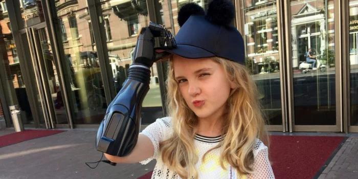 Tilly Lockey will anderen Menschen Hoffnung machen